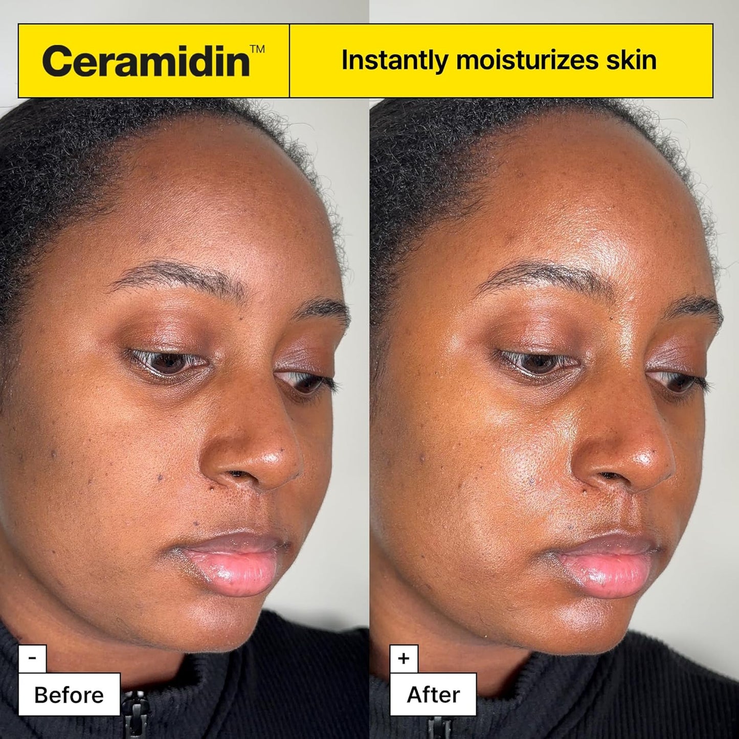 Ceramidin Skin Barrier Moisturizer Cream – Strengthen & Hydrate