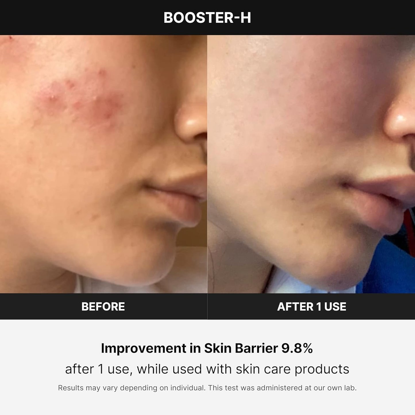 Age-R Booster-H – Instant Glow & Skincare Absorption Device