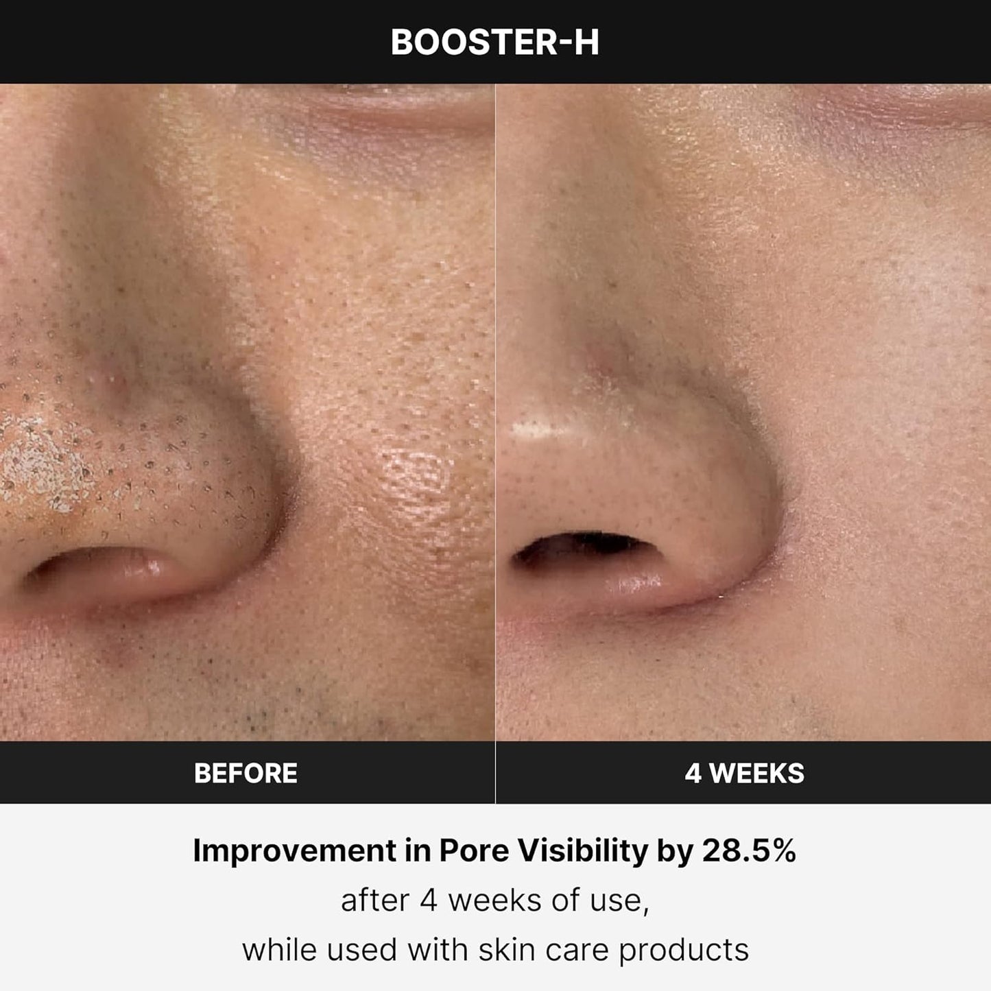 Age-R Booster-H – Instant Glow & Skincare Absorption Device