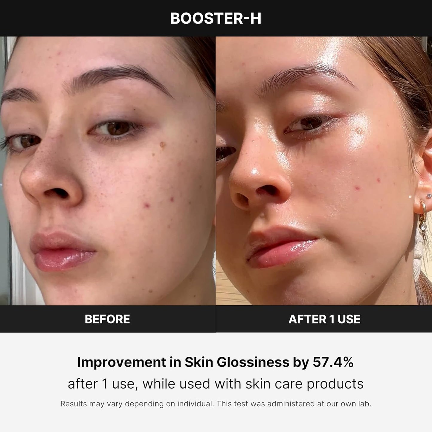 Age-R Booster-H – Instant Glow & Skincare Absorption Device
