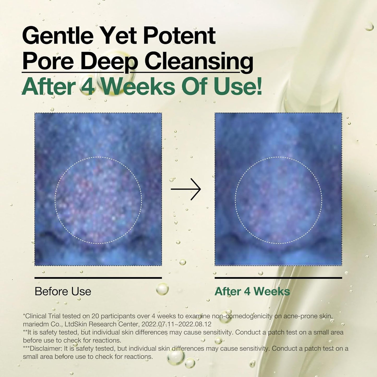 Heartleaf Cleansing Oil – Gentle Makeup & Sebum Remover