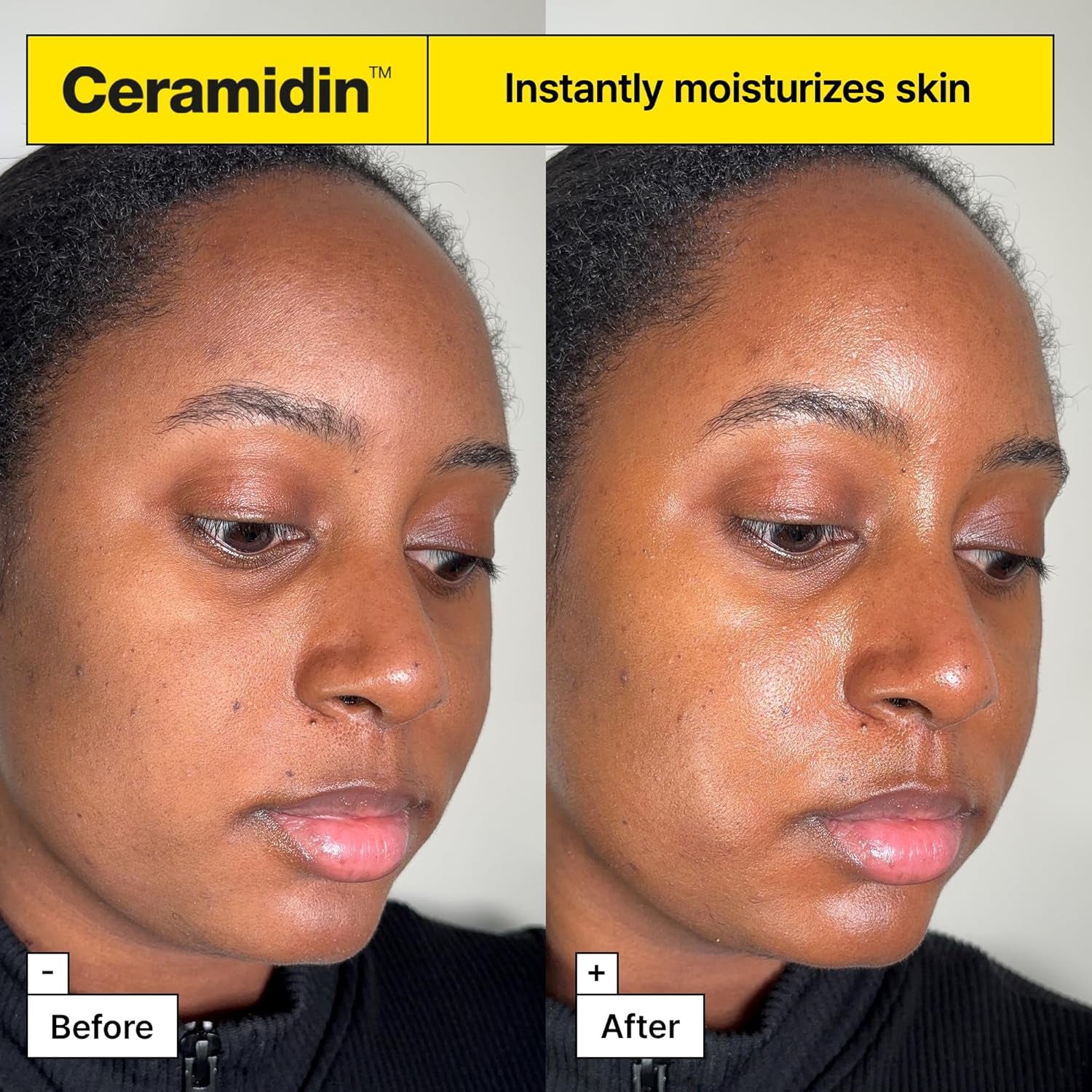 Ceramidin Skin Barrier Moisturizer Cream – Strengthen & Hydrate