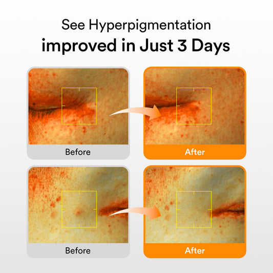 Glutathiosome Dark Spot Serum Vita Drop 