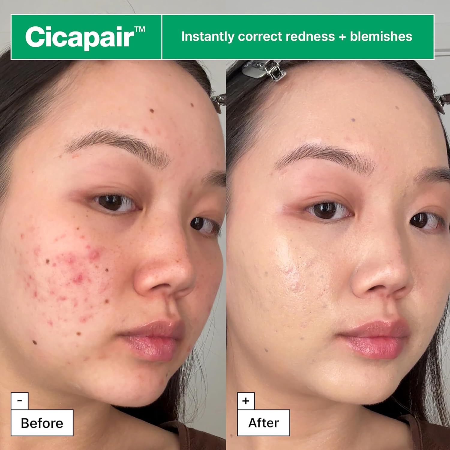 Cicapair Color Correcting Treatment – Redness Neutralizing Cream