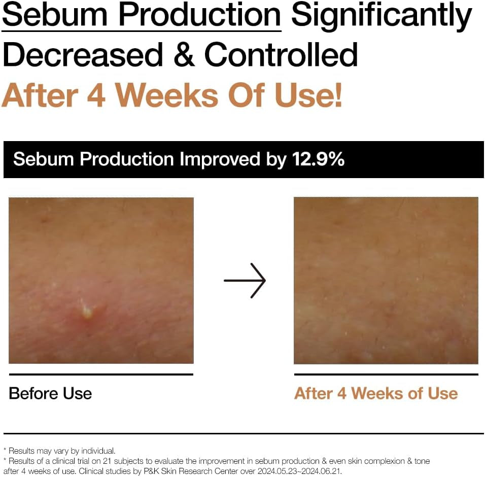 ANUA Rice Water+ Milky Toner for Hydrated Glass Skin